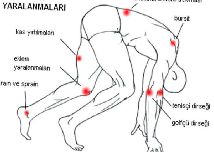 SPOR YARALANMALARI