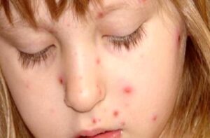 Su Diyeti Nasıl Yapılır, Zararları Nelerdir?