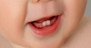 Süt Dişleri Neden Önemlidir?