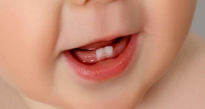 Süt Dişleri Neden Önemlidir?