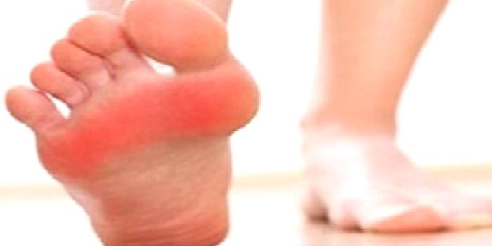 TANISI KONULAMAYAN AYAK TABANI ŞİKAYETLERİNİZ Mİ VAR?