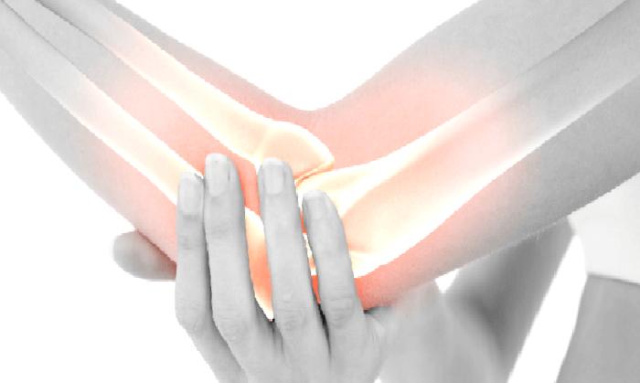 Tenisçi Dirseği – Lateral Epikondilit