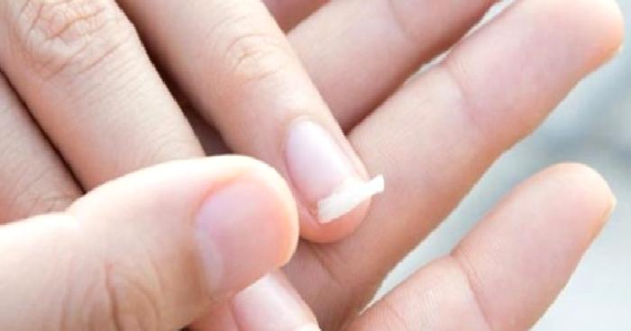 Tırnak Hastalıkları