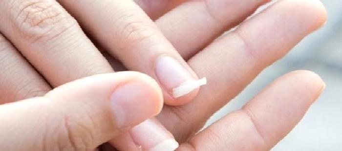 Tırnak Problemleri Hastalıkların Habercisi