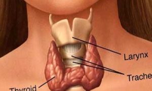 Tiroid Guatr