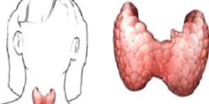 Tiroid Hormonlarının Sentezi