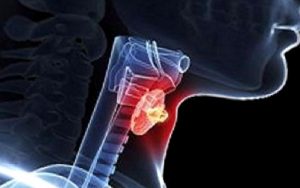 Tiroid Nodülü Nedir ?
