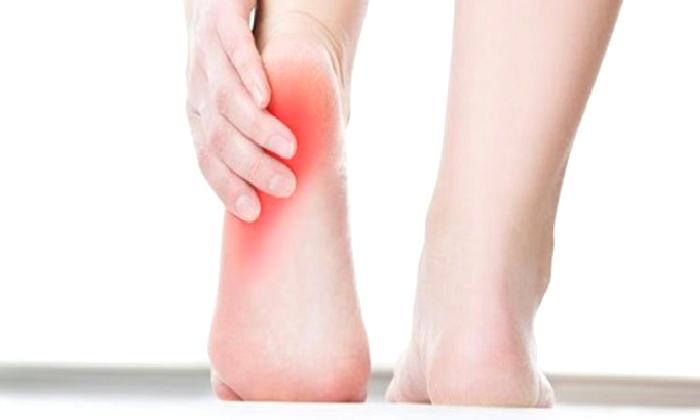 TOPUK DİKENİ TEDAVİSİNDE DOĞAL ÇÖZÜMLER