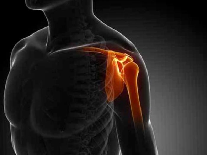 Torasik Outlet Sendromu