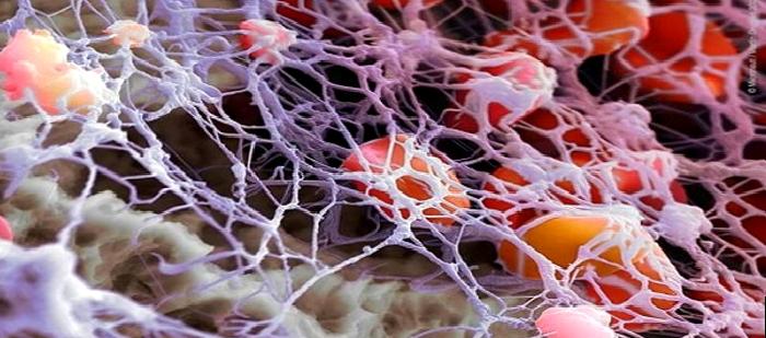 Trombosit Sayım Yüksek: Ne Olabilir?