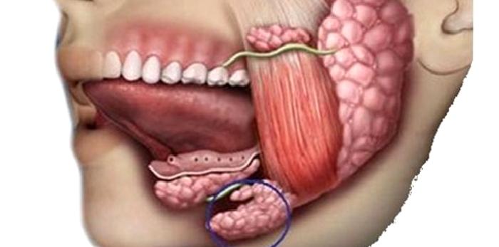 Tükürük Bezi Hastalıklarında Botoks Kullanımı