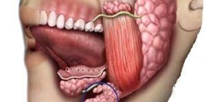 Tükürük Bezi Tümörleri