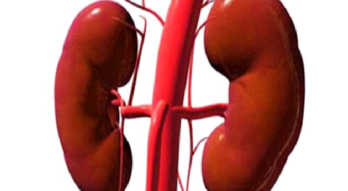 Üreteropelvik Bileşke Darlığı