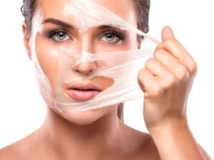 Ürtiker (Kurdeşen)