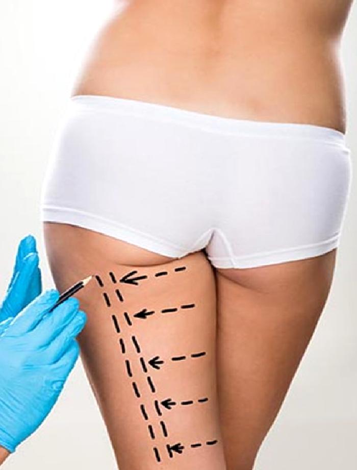 UYLUK GERME / BACAK GERME AMELİYATI