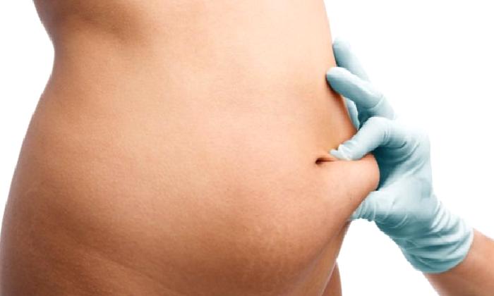 Yağ alma (liposakşın – lipoplasti)