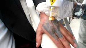 YAPTIRMASI UZUN, SİLDİRMESİ BİR KAÇ DAKİKA…