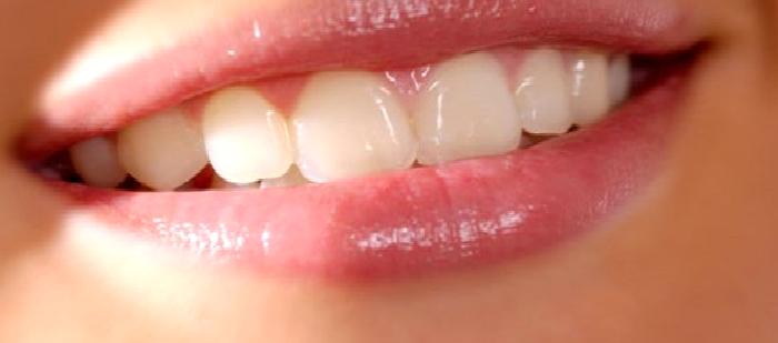 Yirmi Yaş Dişi Çekimi ile İlgili Bilinmesi Gerekenler