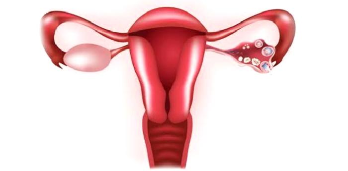 Yumurtalık Kistim Var, Endişe Etmeli Miyim?