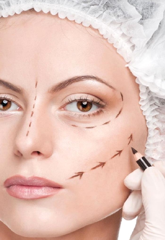 Yüz Germe Ameliyatı