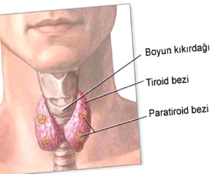Zehirli Guatr (Hipertiroidi)