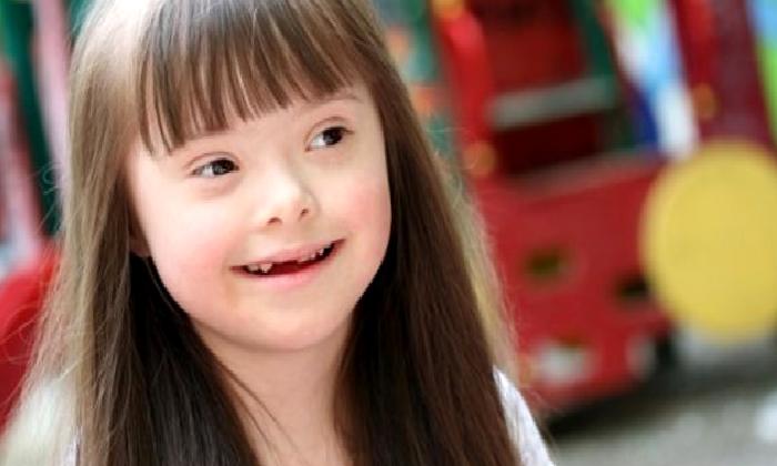 ZİHİNSEL ÖZÜRLÜ ÇOCUKLAR