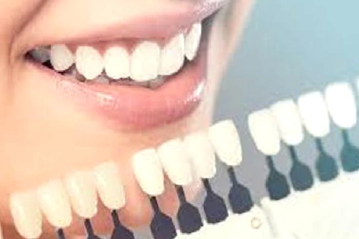 Zirkonyum Destekli Porselen