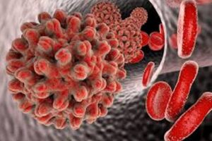 Penis Kalınlaştırma Ameliyatı Nedir?