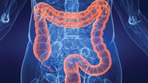 Bağırsak Sağlığı = Ruh Sağlığı