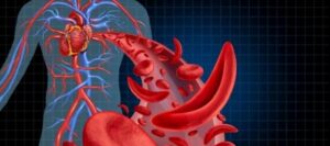 Damar Tıkanıklığı Nasıl Anlaşılır?