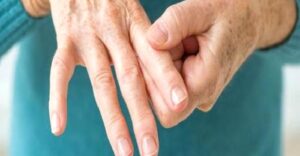 Romatizmal Hastalıkların Belirtileri