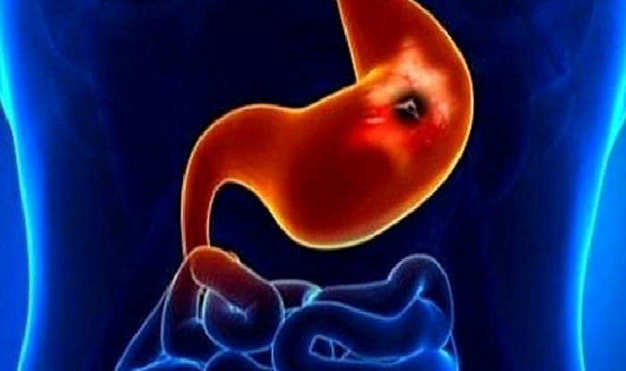 Yaşlı Hastalarda Ülserler