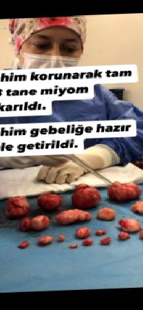 Genç ve çocuk sahibi olmak isteyen hastalarda rahim koruyucu miyom ameliyatı