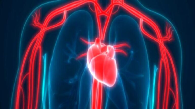 Stent mi, bypass mı?