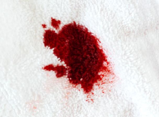 Kızlık zarı kanama miktarı nedir?