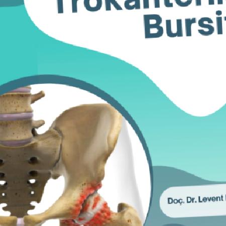 Trokanterik bursit