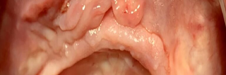 Küçük işaretler büyük sorunların habercisi olabilir !