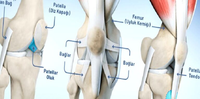 Diz Kapağı Kayması ve Diz Kapağı Çıkması: Belirtileri ve Tedavisi