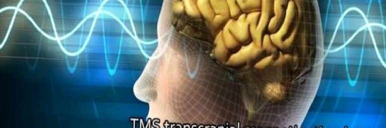 Kulak Çınlamasında yeni umut TMS tedavisi