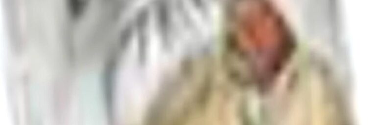 Lateral Collateral Ligament and Biceps Femoris Tendon Fixation with a Suture Anchor to the Tibial Metaphysis after Proximal Fibula En Bloc Resections Preserve Lateral Knee Stability