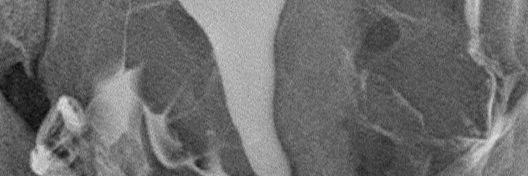 Rahim filmi [HSG] çekiminde teknik ve teknolojik yenilikler