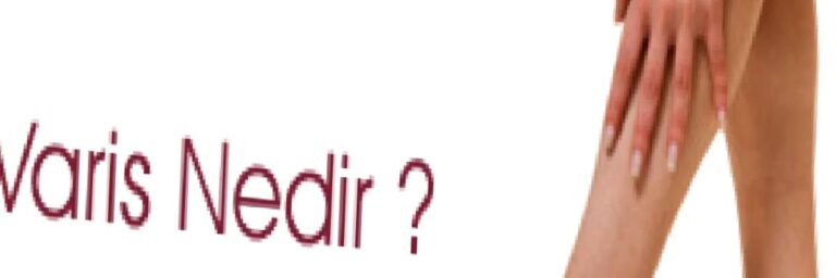 VARİS NEDİR?
