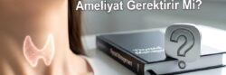Tiroid Nodüllerinin Hepsi Ameliyat Gerektirir mi?